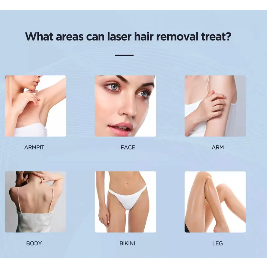 Athena 4D Laser Hair Removal Machine - Image 5