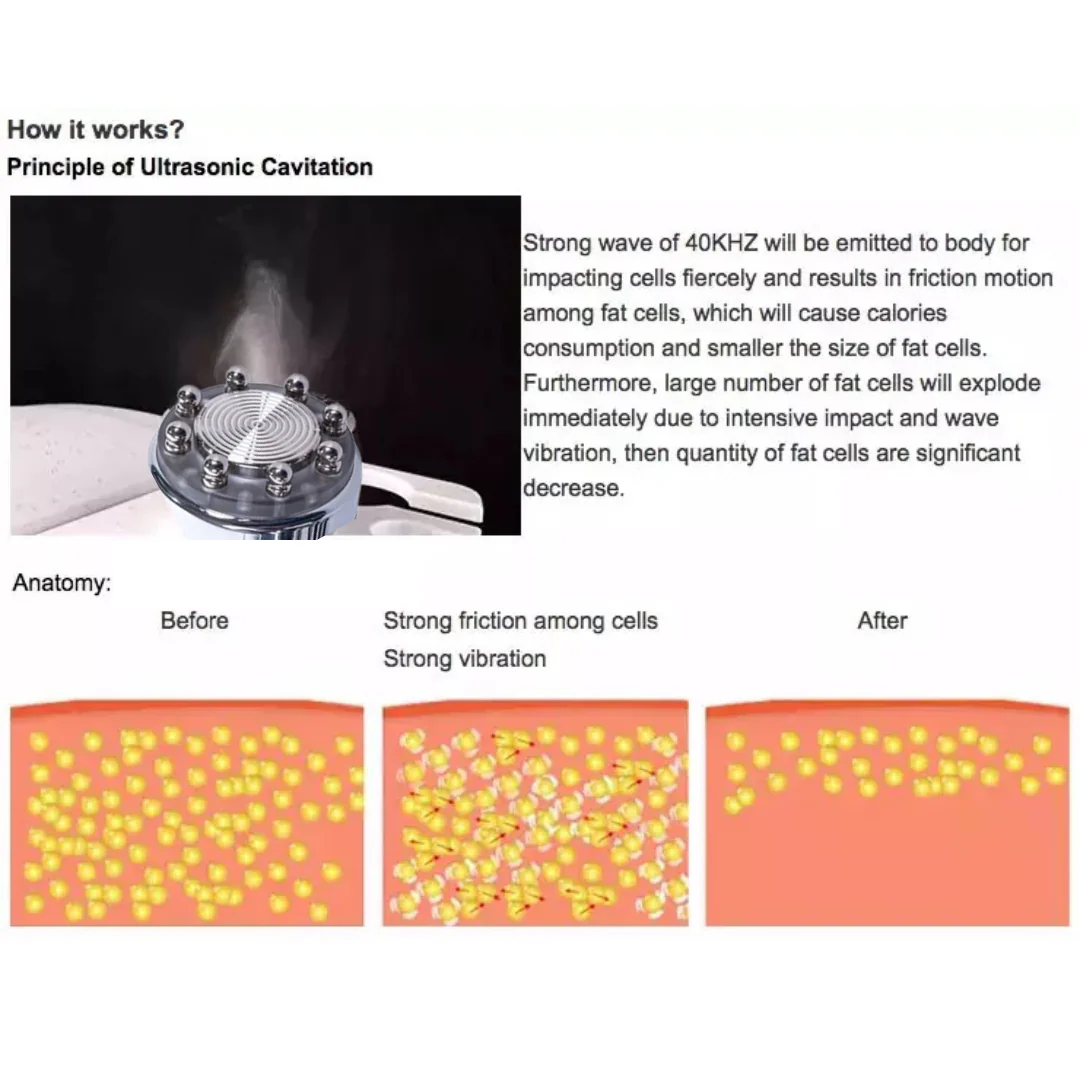 Marla 6 in 1 Cavitation Machine - Image 8