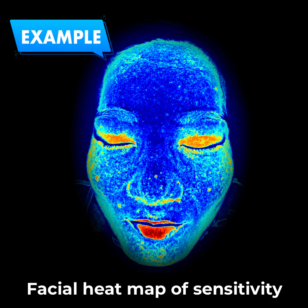 Imagica™ Skin Analyzer & Sharing System - Image 11