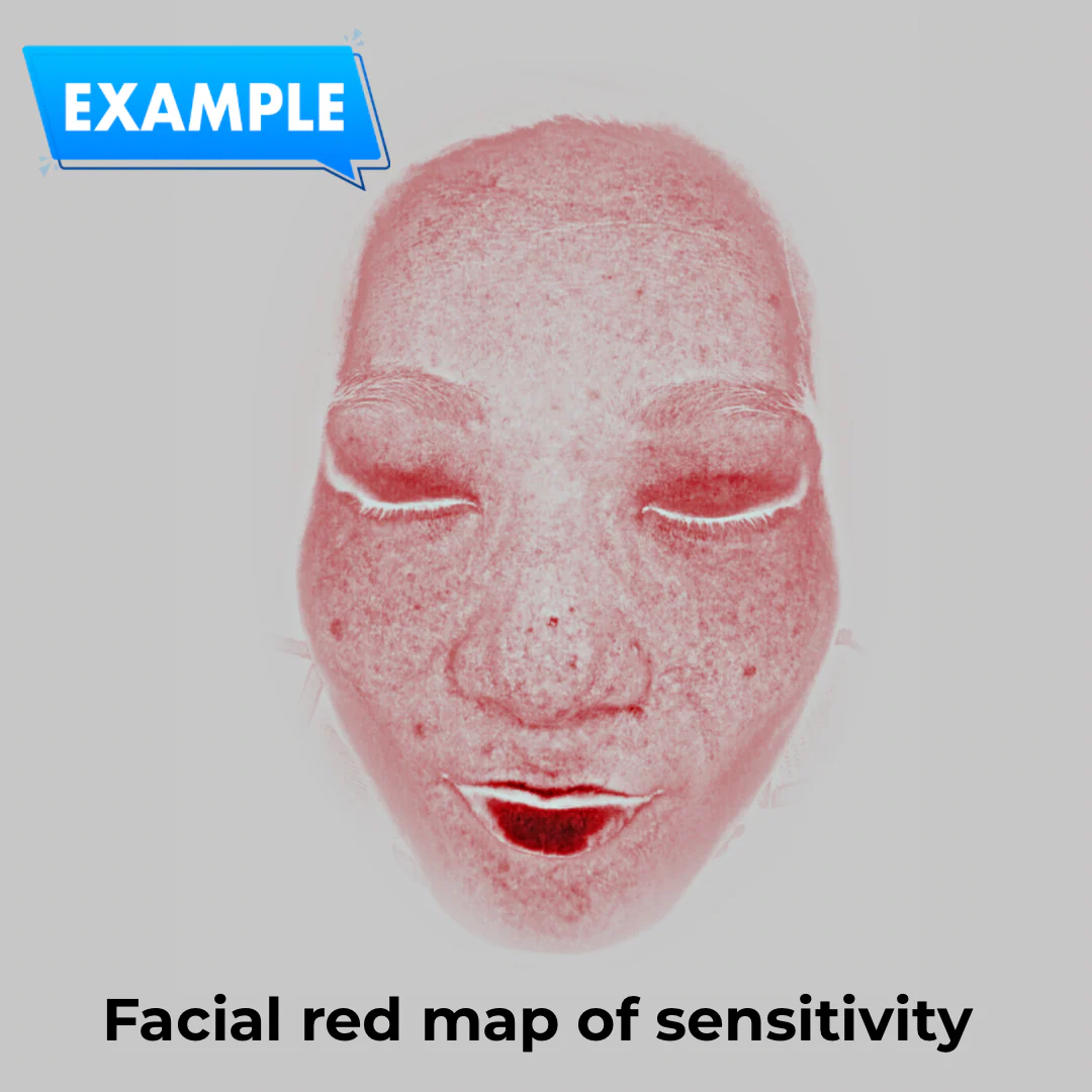 Imagica™ Skin Analyzer & Sharing System - Image 9