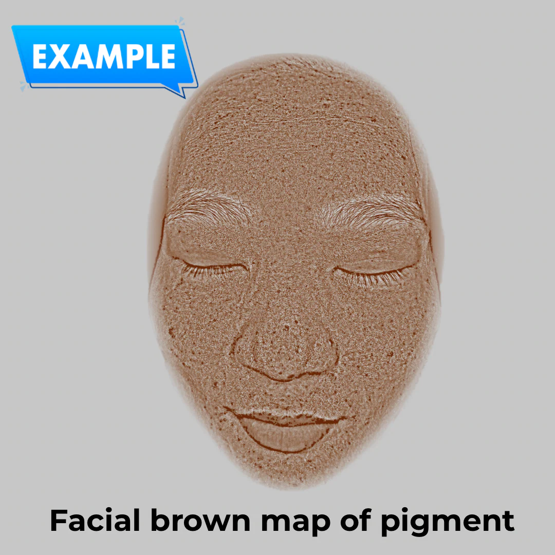 Imagica™ Skin Analyzer & Sharing System - Image 10