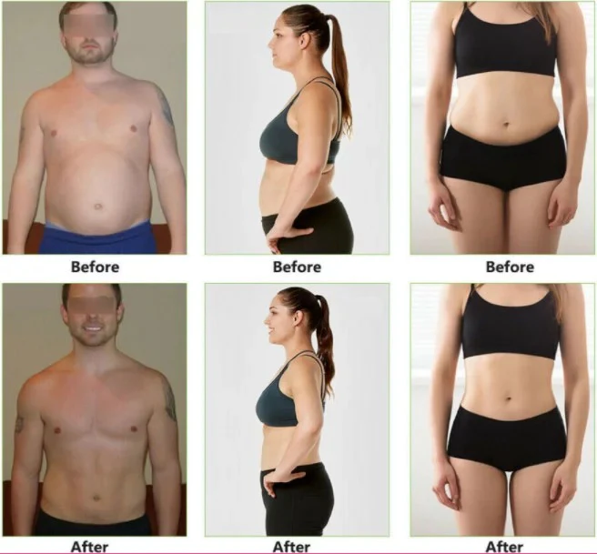 Marla™ 9 in 1 Cavitation Lipo Laser Body Sculpting Machine - Image 4