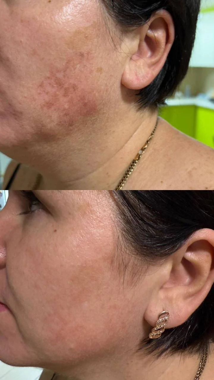 DuoSmooth 2-in-1 Diode Laser + IPL System - Image 11