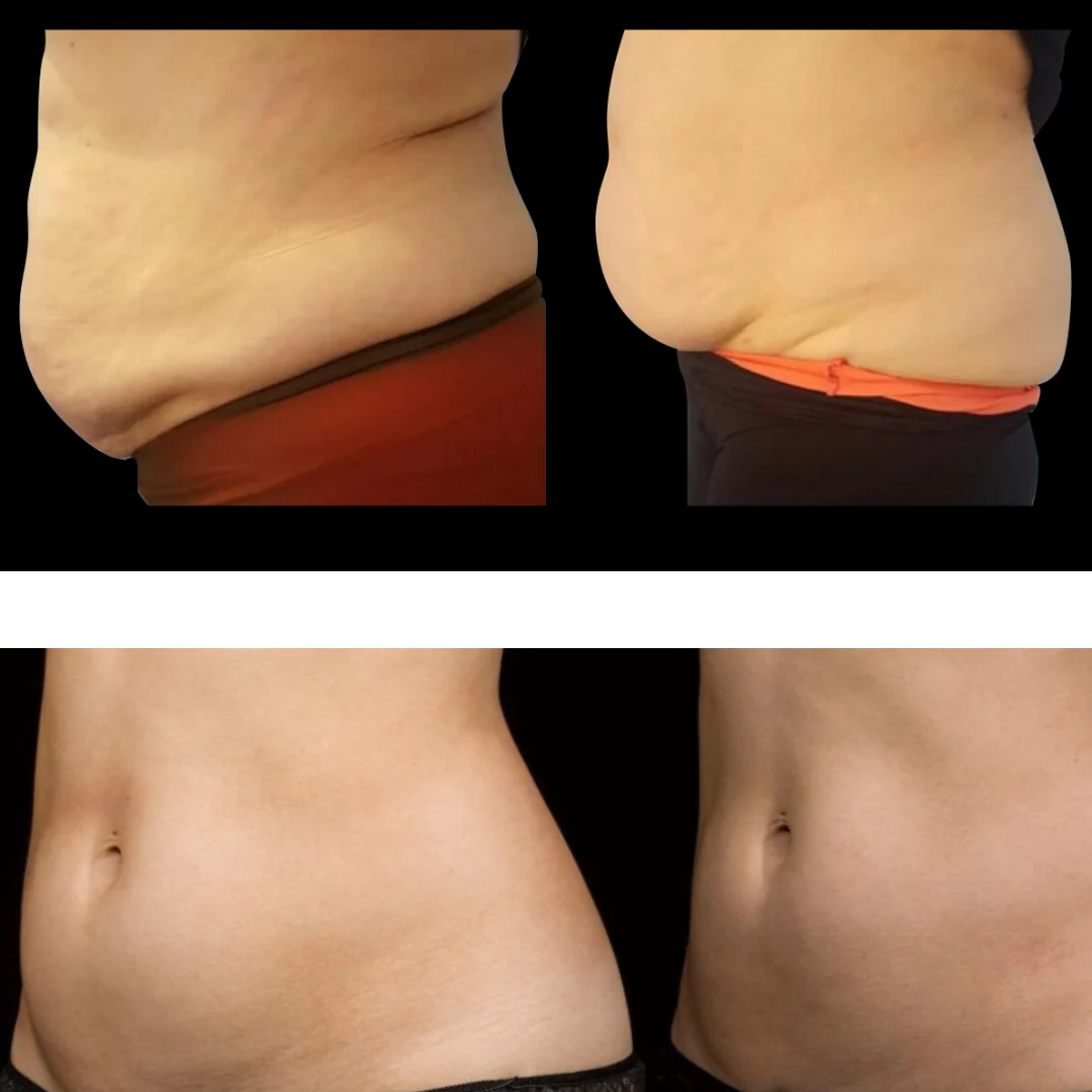 Eris® Lipo Cavitation Machine 6 in 1 Professional - Image 13