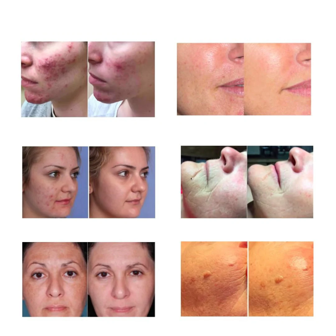 Light Goddess PRO Intensely Therapeutic Skin Revitalizer - Image 3