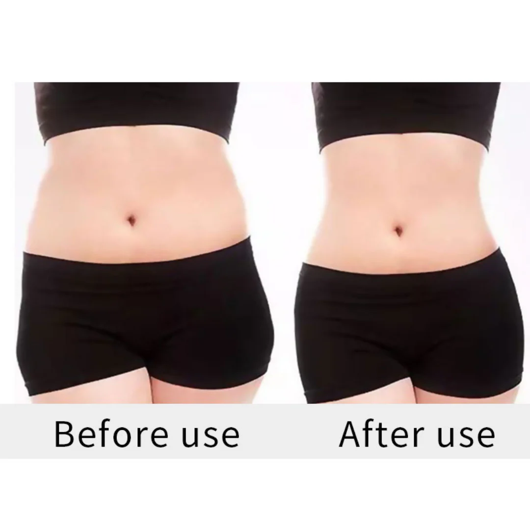 Adonis™ 6 in 1 Cavitation Machine for Fat Blasting - Image 11