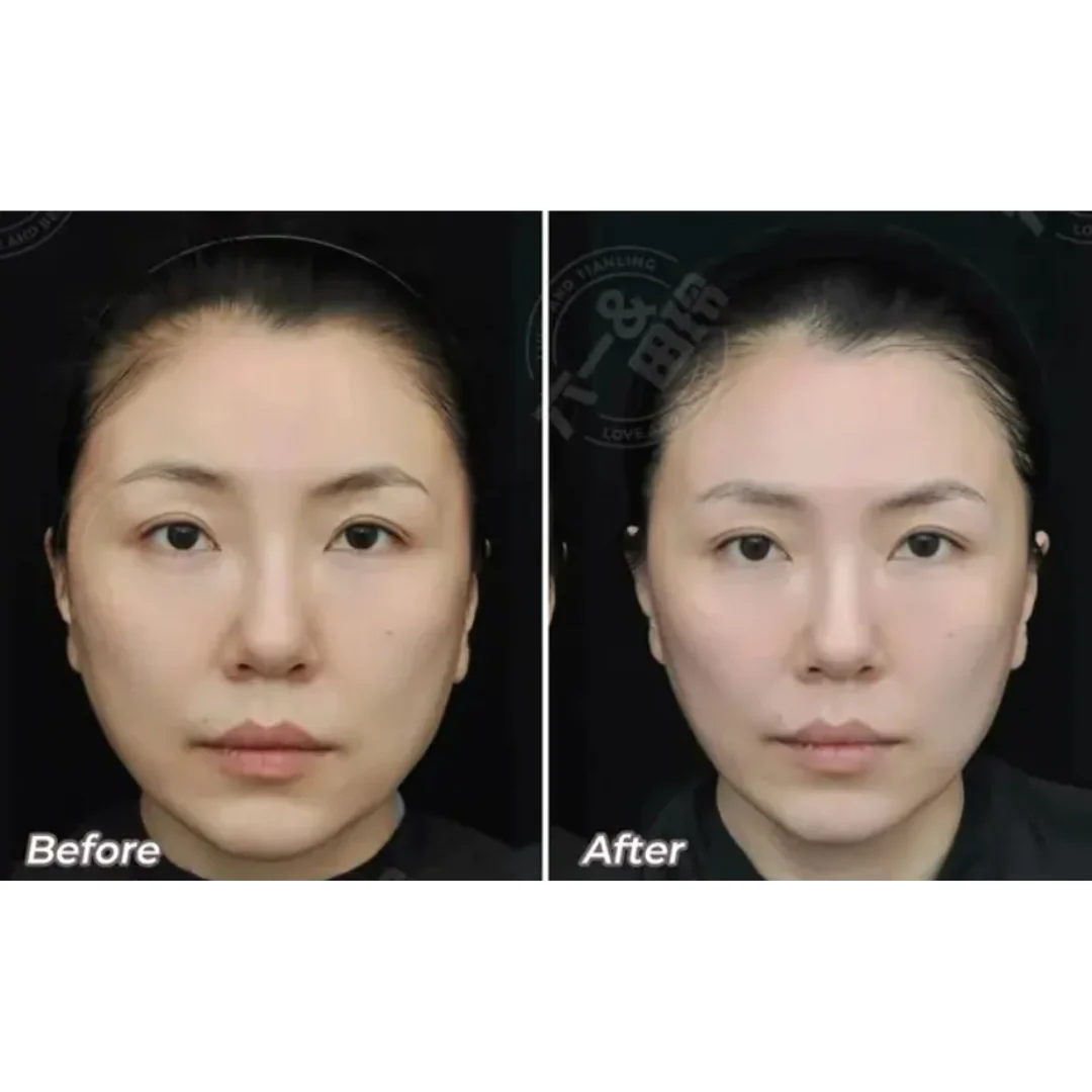 PERFECT FACE NEO 6D Complete - Image 15