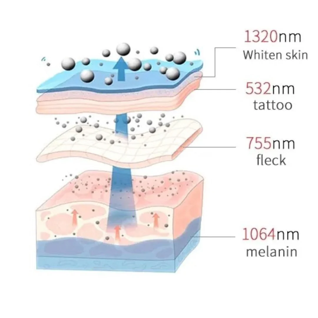 PicoElim™ Pico Laser Tattoo Removal Machine - Image 4