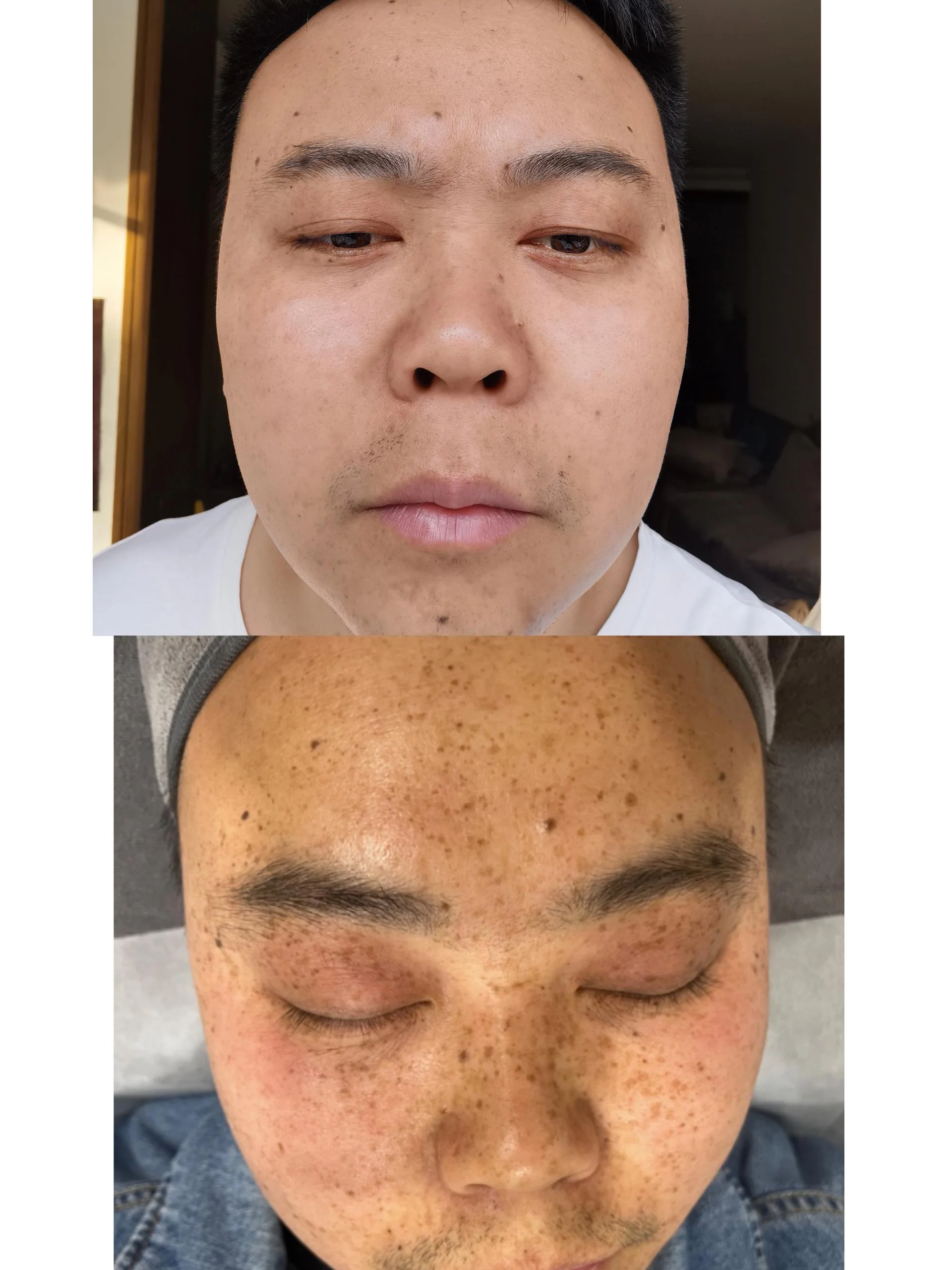 PicoPretty® Picosecond Laser - 4D Complete Pigment Solution - Image 10