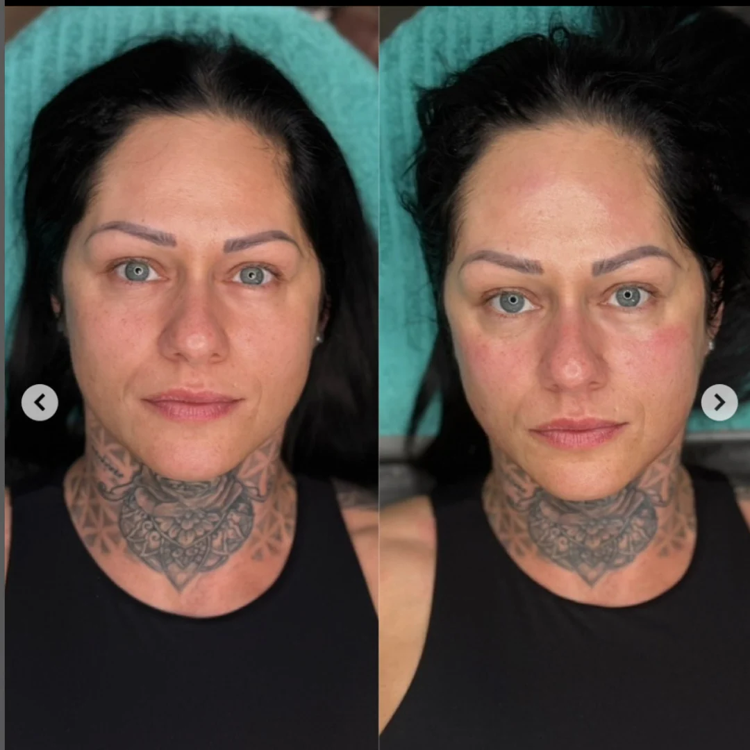 Professional PERFECT SHAPE® NEO PLUS (Body & Face) - Image 9