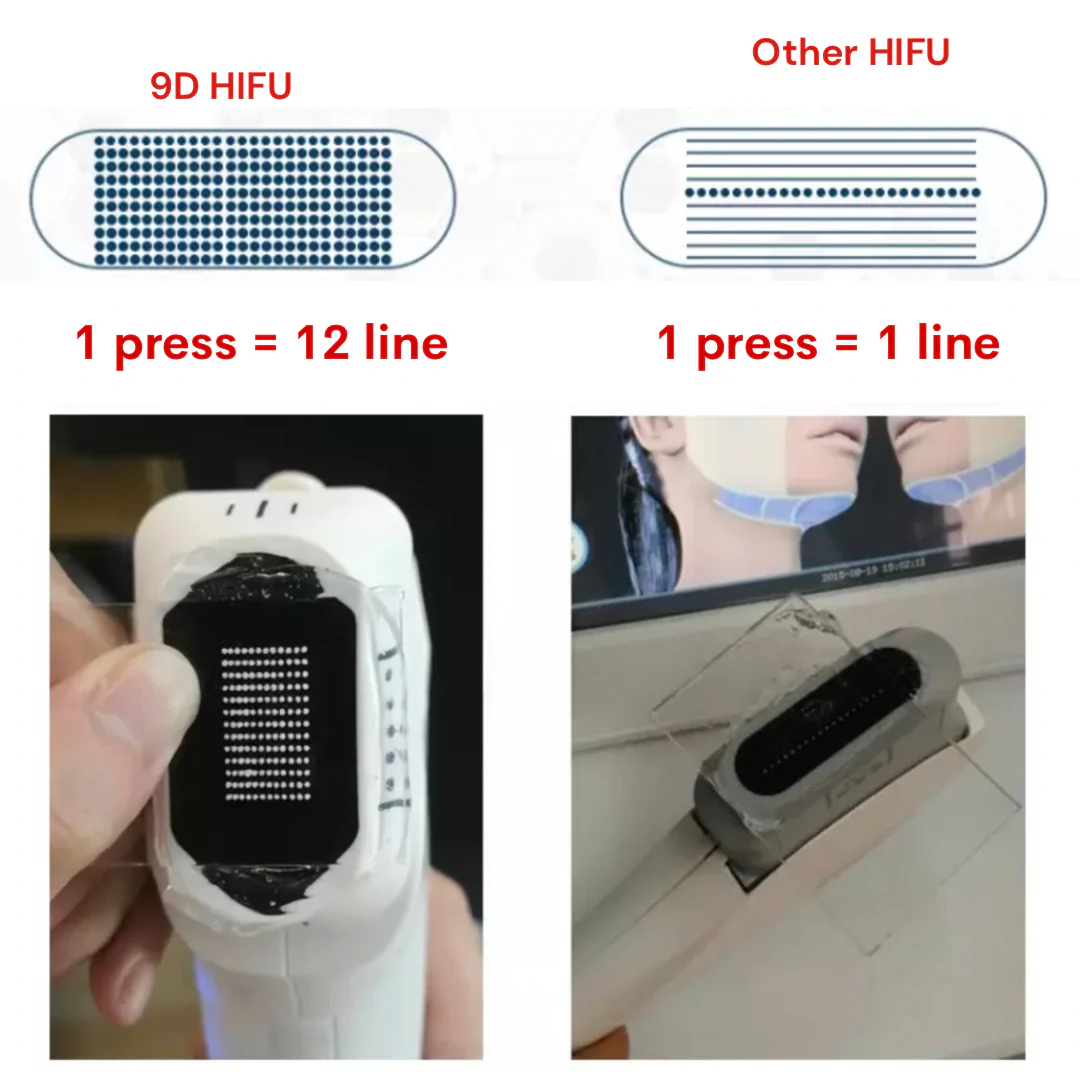 Replacement Cartridge for 9D Face Lifting HIFU Machine - Image 7