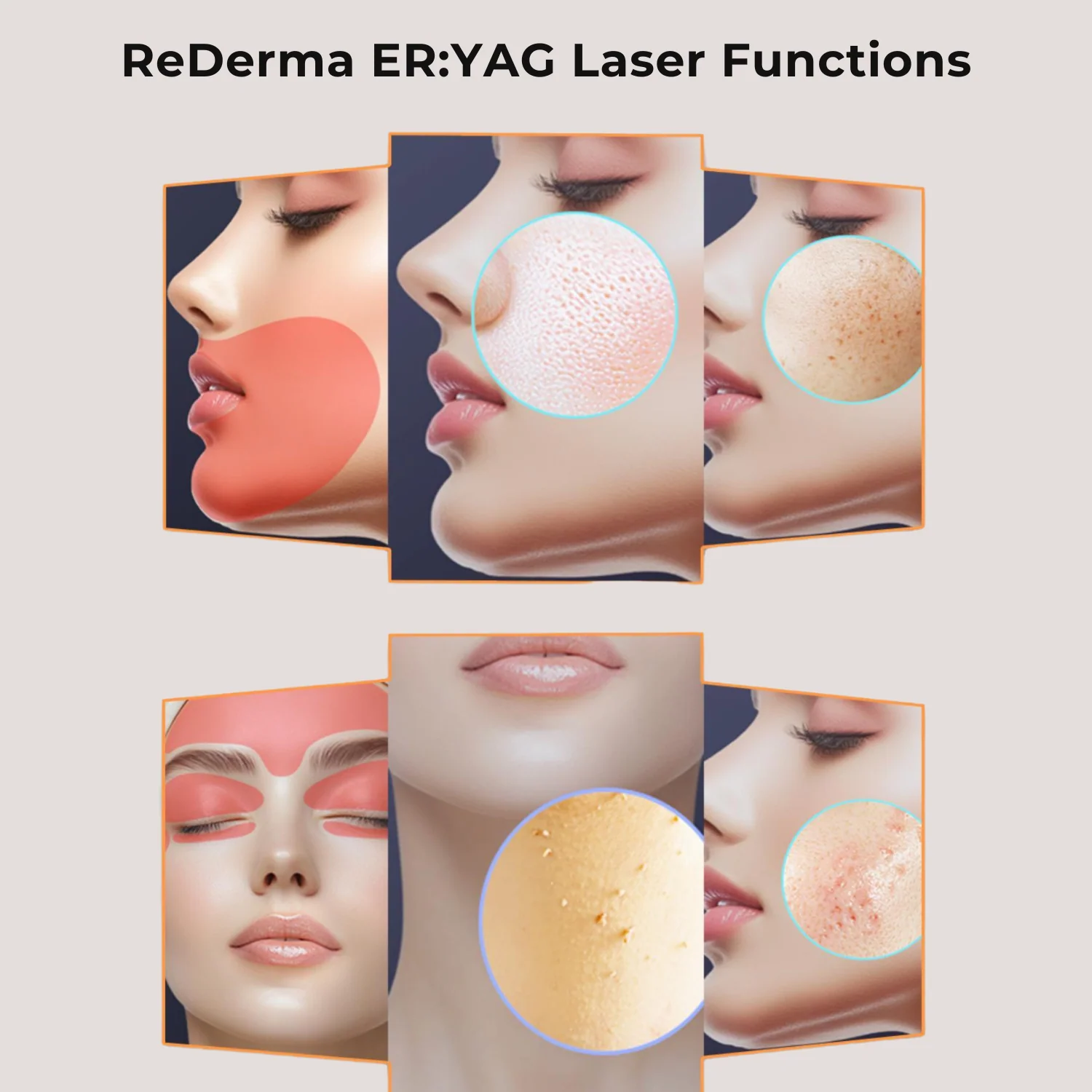 Tattoo Removal Laser Excellence Bundle B - Image 2