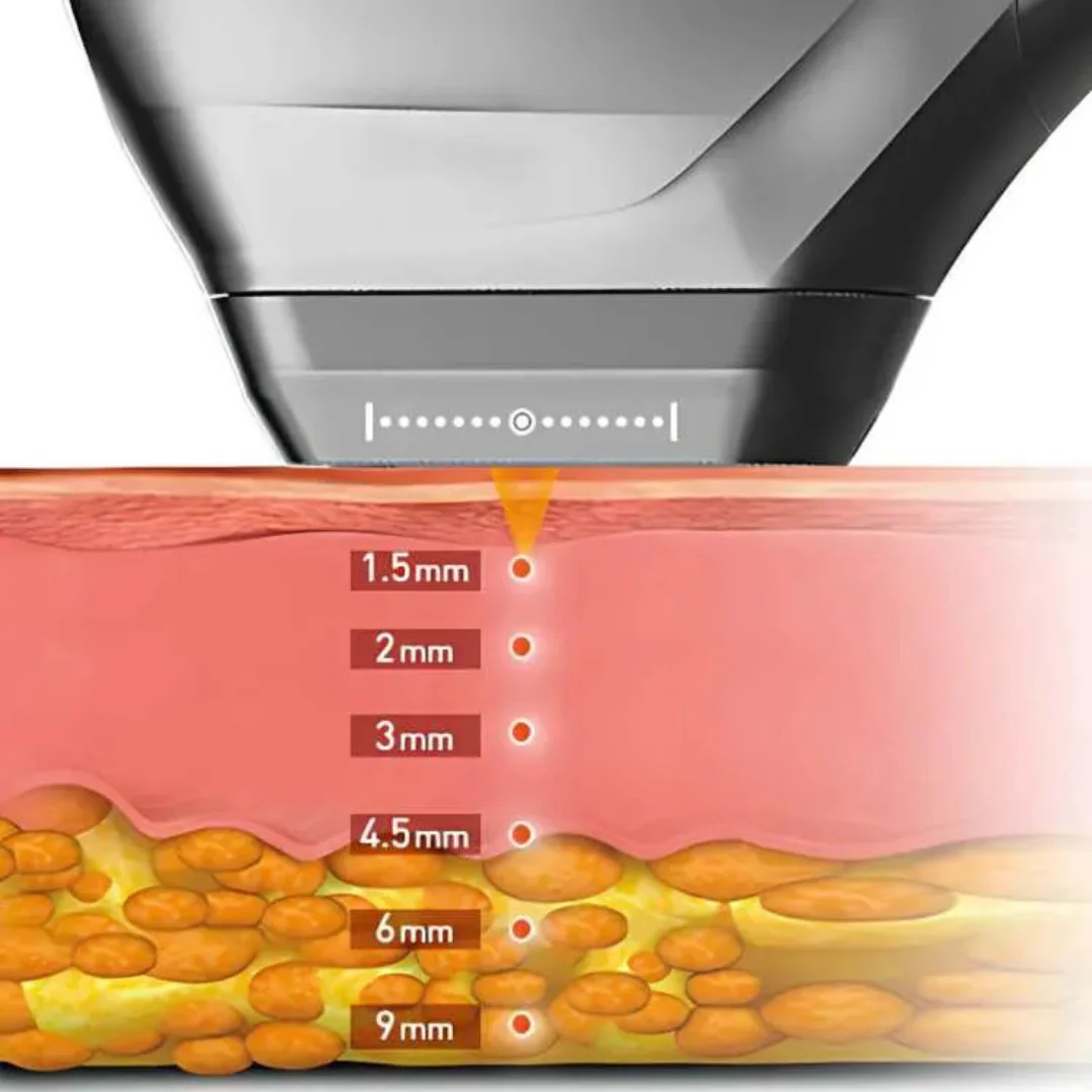 LuminaTight™ 10D HIFU Machine Professional - Image 3