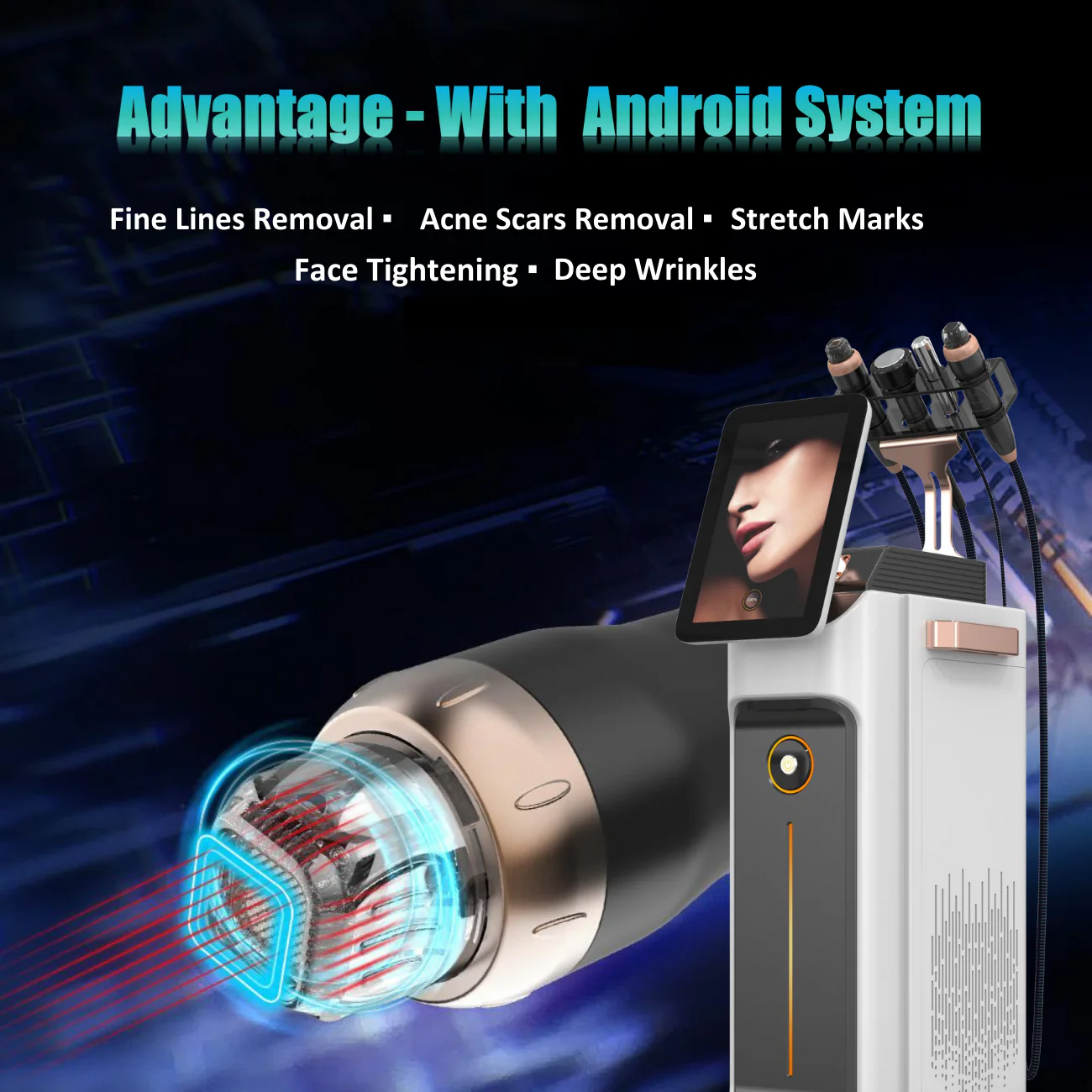 Proteus-V™ RF Micro-needle + Thermagica Fractional RF System - Image 6